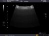 TOSHIBA PVT-745BTV Ultrasound Transducer
