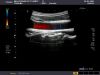 TOSHIBA PVT-745BTV Ultrasound Transducer