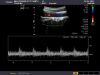 TOSHIBA PVT-745BTV Ultrasound Transducer