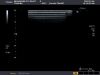 TOSHIBA PLT-604AT Ultrasound Transducer