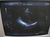 TOSHIBA PST-37CT Ultrasound Transducer