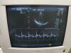 TOSHIBA PST-37CT Ultrasound Transducer