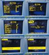 ASPECT 2008  Med A-2000 Bis-XP Monitor W/ DSC-XP Module, Clamp & PIC Cable