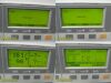 PHILIPS Agilent Series 50XM M1350B Maternal Fetal Monitor