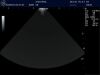 GE 5S Ultrasound Transducer