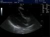 GE 5S Ultrasound Transducer