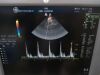GE 10S Ultrasound Transducer