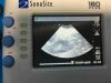 SONOSITE C15e / 4-2 MHz Microconvex Probe for Sonosite 180 Plus