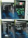GE Dash 3000, (2023615-101) NBP,ECG,TEMP/CO,SpO2 W/ Patient Leads ~ Monitor
