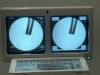 OEC 9800  MD C-Arm