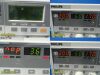 PHILIPS Series 50XM M1350B Maternal Fetal Monitor