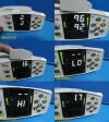 MASIMO Rad 87  Set Rainbow Patient Monitor