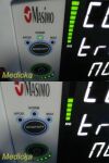 MASIMO Rad 87  Set Rainbow Patient Monitor