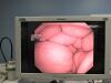 OLYMPUS BF-Q180 Bronchoscope