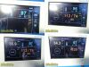 SPACELABS Ultraview DM3 Vital Monitor