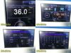 SPACELABS Ultraview DM3 Vital Monitor