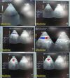 GE HEALTHCARE GE 10S Sector Array Ultrasound Transducer