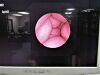 OLYMPUS BF-XP160F Bronchoscope