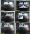 GE HEALTHCARE GE 3.5C Convex Array Ultrasound Transducer