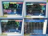 PHILIPS M8002A Intellivue MP30,W/ M3001A Module & Patient Leads ~ Monitor