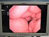 OLYMPUS BF-1TQ180 Bronchoscope