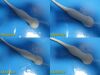 PHILIPS X7-2 Matrix Array Ultrasound Transducer