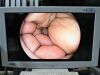FUJINON EC-600HL Colonoscope