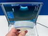 GE portable Logiq E with 12L-rs and C4-1 conevex Ultrasound - Vascular - Small Parts