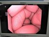 OLYMPUS CF-Q180AL Colonoscope