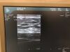 B&K Pro Focus 2202 Ultrasound Scanner Ultrasound - Cardiac - Vascular