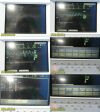 MASIMO 2012  Rad-87 Rainbow SpO2 Monitor