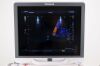 TOSHIBA SSA-790A APLIO XG Ultrasound System