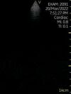 GE Vscan Single Probe Handheld Ultrasound Scanner (GM000180) Ultrasound - Cardiac