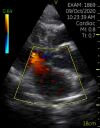 GE Vscan Single Probe Handheld Ultrasound Scanner (GM000180) Ultrasound - Cardiac