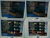SPACELABS Ultraview 91369 Spacelabs Ultraview 91369 Patient Monitoring System