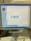 GE HEALTHCARE CASE V6 Stress Test