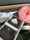 GE 8C Ultrasound Transducer