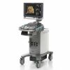 SIEMENS Acuson X300 PE Ultrasound - Shared Service