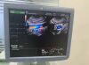 GE RIC5-9-D Ultrasound Transducer