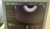 GE RIC5-9-D Ultrasound Transducer