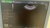 GE RIC5-9-D Ultrasound Transducer