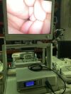 STRYKER 1188 , x8000 . Laparoscopy tower