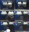 PHILIPS C9-4 Convex Array Ultrasound Transducer