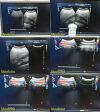 PHILIPS C9-4 Convex Array Ultrasound Transducer