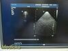 PHILIPS X7-2 Matrix Phased Array Ultrasound Transducer