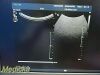 PHILIPS C9-4 P/N 453561212363 Convex Array Ultrasound Transducer