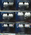 PHILIPS C9-4 P/N 453561212363 Convex Array Ultrasound Transducer