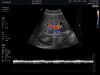 HITACHI CA2-8AD-H Ultrasound Transducer