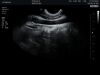 HITACHI EVN4-9-H Ultrasound Transducer