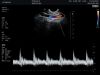 HITACHI EVN4-9-H Ultrasound Transducer